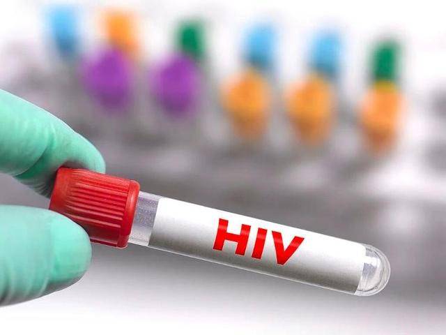 感染了HIV≠得了艾滋病！关于艾滋病，这些要了解→